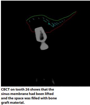 cbct