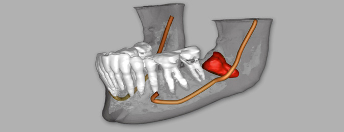 Dental-3D-Imaging